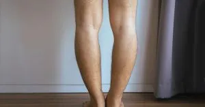 پاهای پرانتزی