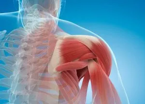 متلازمة الألم تحت الأخرم