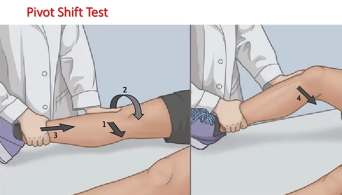 تست Pivot shift