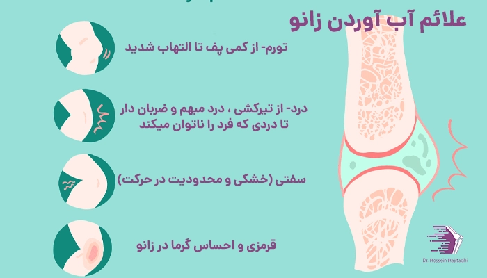 علائم آب آوردن زانو 