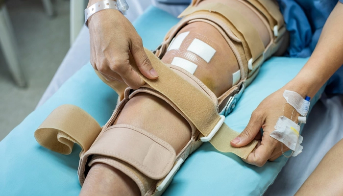 مراقبت های بعد از جراحی رباط صلیبی